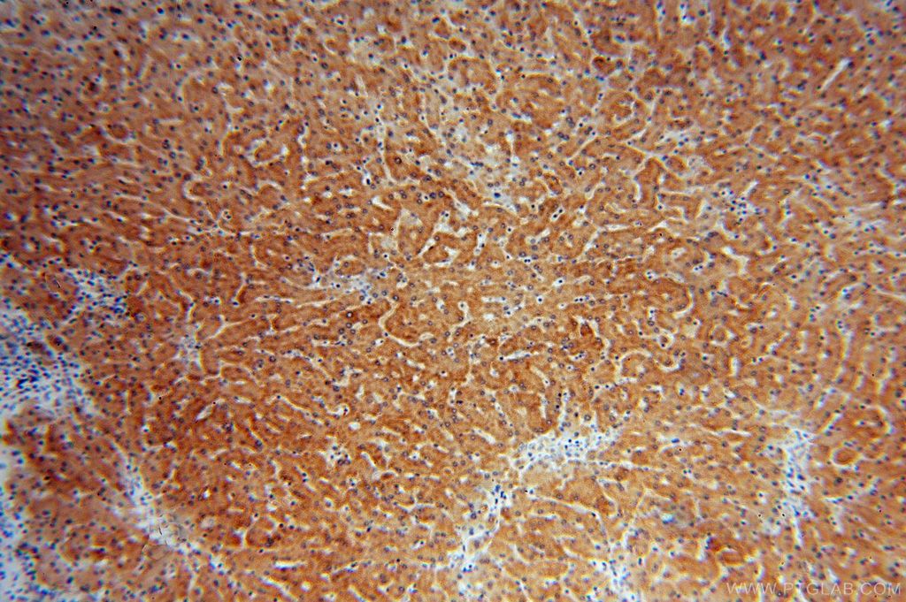 Immunohistochemistry of paraffin-embedded human liver using 16546-1-AP(CYP2C8 Antibody) at Dilution 1:50 (under 10x lens) CYP2C8 IHC Immunohistochemical 16546-1-AP CYP2C8 Antibody CPC8; MP-12/MP-20