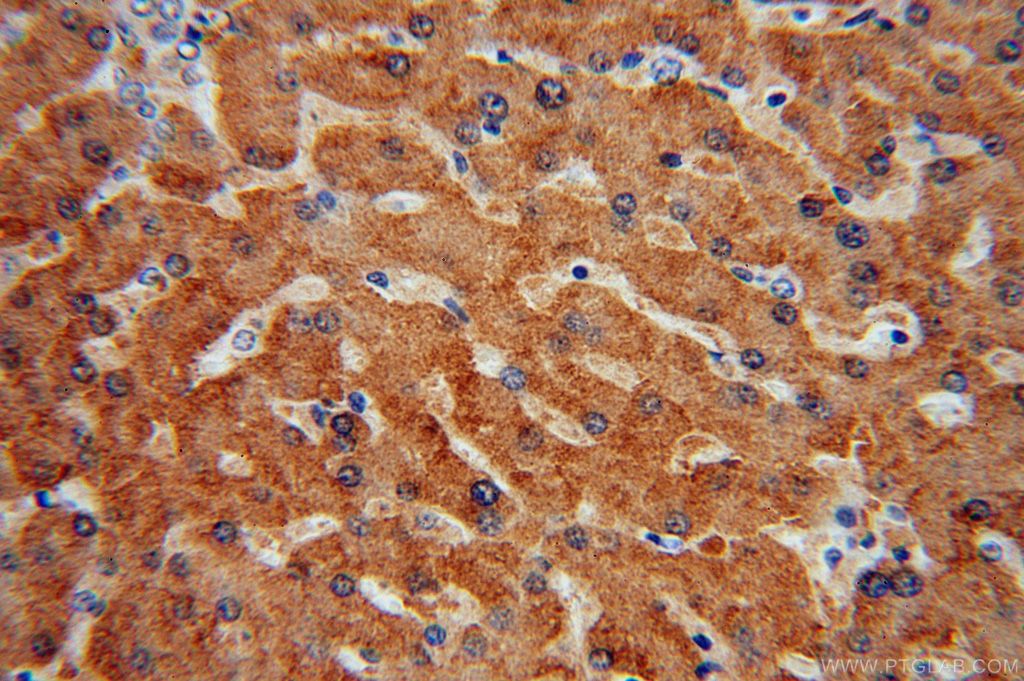 Immunohistochemistry of paraffin-embedded human liver using 16546-1-AP(CYP2C8 Antibody) at Dilution 1:50 (under 40x lens) CYP2C8 IHC Immunohistochemical 16546-1-AP CYP2C8 Antibody CPC8; MP-12/MP-20