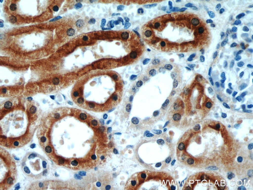 CYP4A11 IHC Immunohistochemical 11688-1-AP CYP4A11 Antibody CP4Y; CYP4A2; CYP4AII