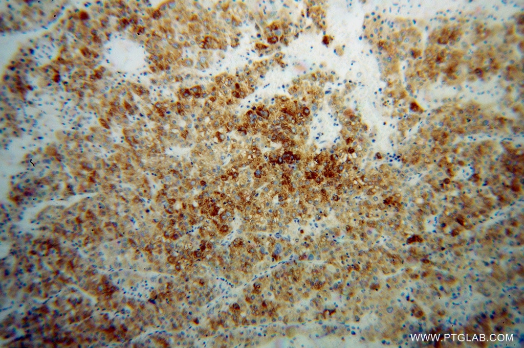 CYP4F11 IHC Immunohistochemical 12286-1-AP CYP4F11 Antibody 