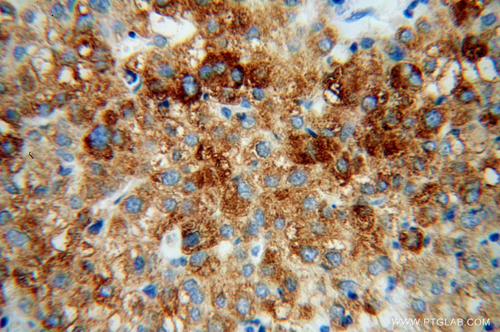CYP4F11 IHC Immunohistochemical 12286-1-AP CYP4F11 Antibody 