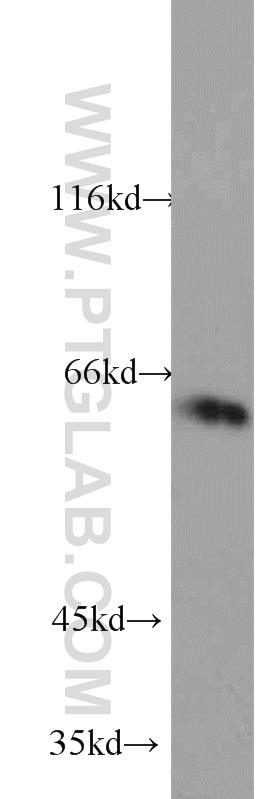 CYP4F11-Specific western blot WB 20012-1-AP CYP4F11-Specific Antibody 