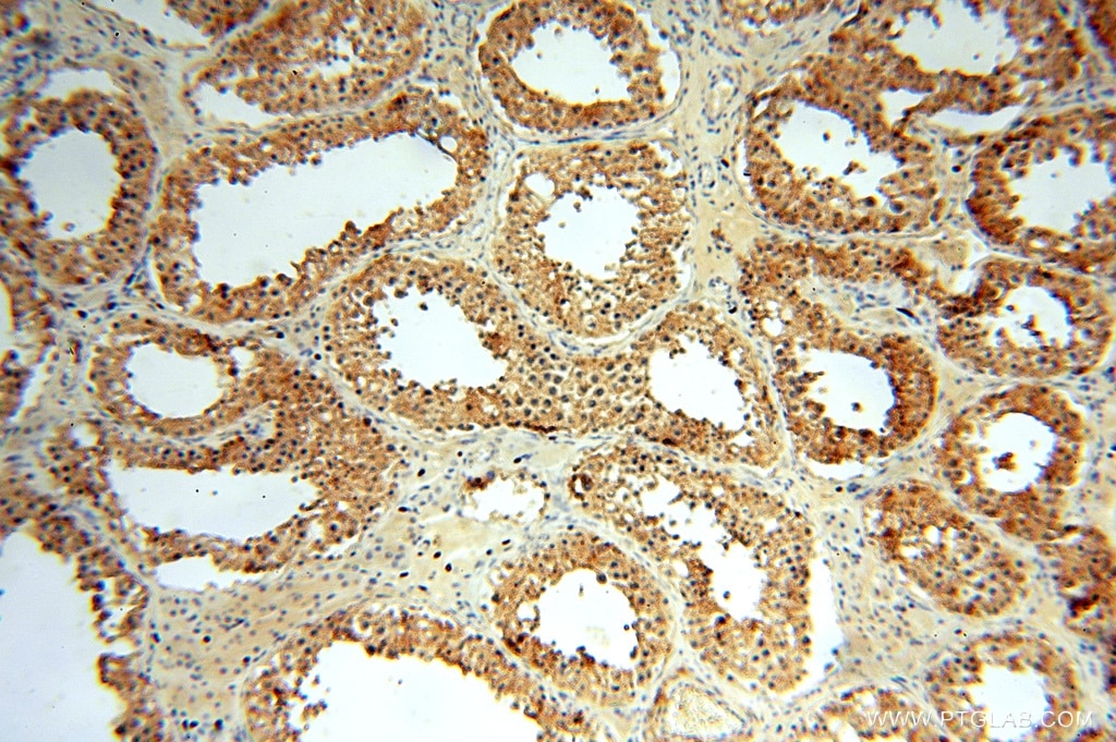 CYTL1 IHC Immunohistochemical 15856-1-AP CYTL1 Antibody C17; C4orf4