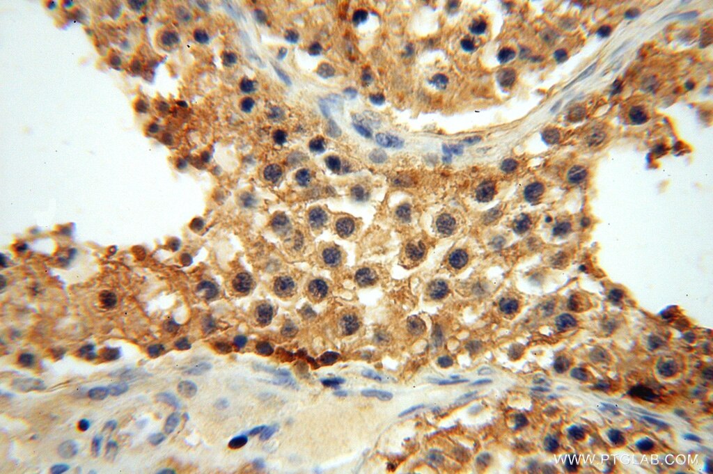 CYTL1 IHC Immunohistochemical 15856-1-AP CYTL1 Antibody C17; C4orf4