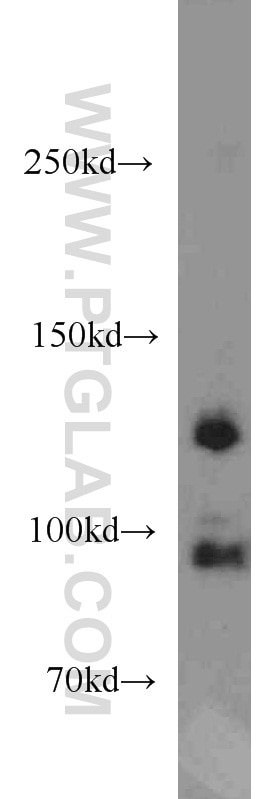mouse kidney tissue were subjected to SDS PAGE followed by western blot with 13851-1-AP(CYTSB Antibody) at dilution of 1:1000 CYTSB western blot WB 13851-1-AP CYTSB Antibody FLJ36955; HCMOGT-1; NSP; SPECC1