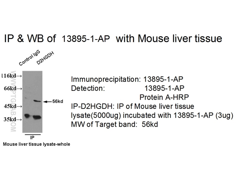 D2HGDH IP 13895-1-AP D2HGDH Antibody D2HGD; FLJ42195; MGC25181