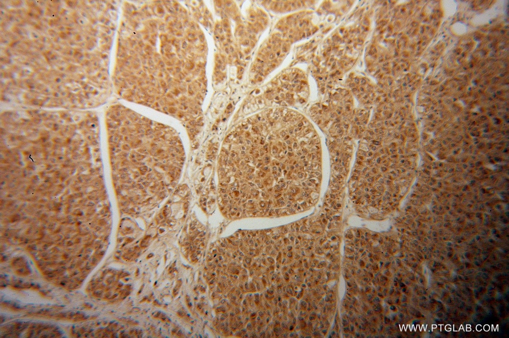 D2HGDH IHC Immunohistochemical 13895-1-AP D2HGDH Antibody D2HGD; FLJ42195; MGC25181