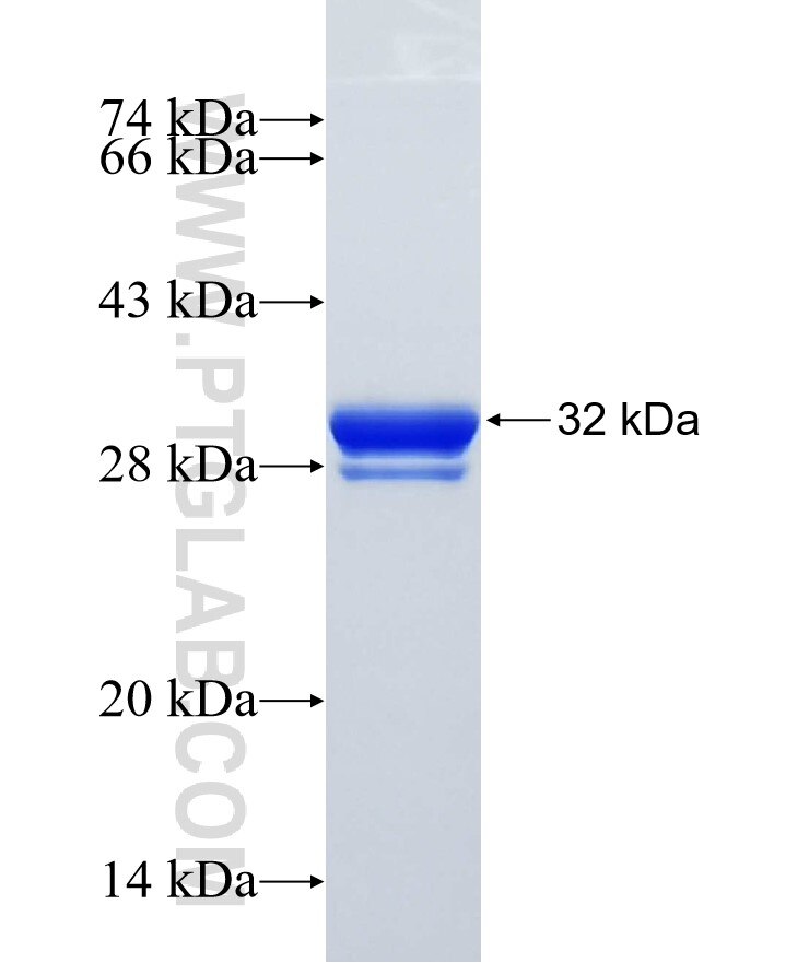 DAAM2 fusion protein ag18955 SDS-PAGE