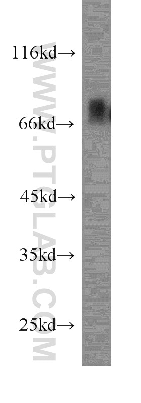 NIH/3T3 cells were subjected to SDS PAGE followed by western blot with 13076-1-AP(DBF4 Antibody) at dilution of 1:300 DBF4 western blot WB 13076-1-AP DBF4 Antibody ASK; CHIF; DBF4A; ZDBF1