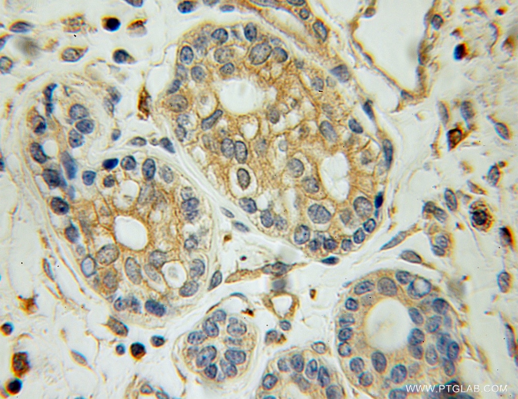 DBNL IHC Immunohistochemical 13015-1-AP DBNL Antibody ABP1; HIP-55; SH3P7
