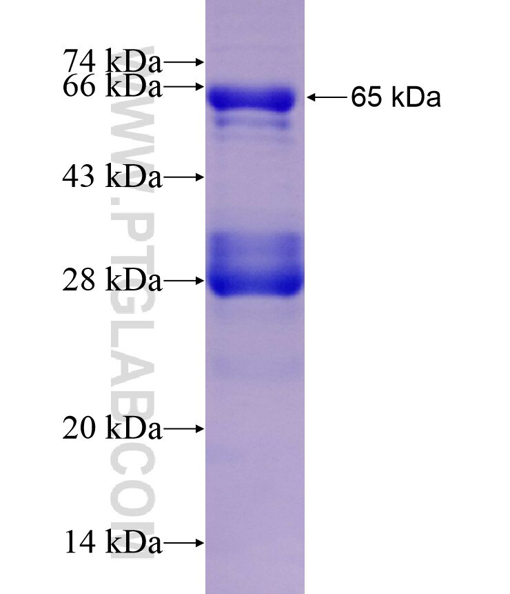 DCPS fusion protein ag8726 SDS-PAGE