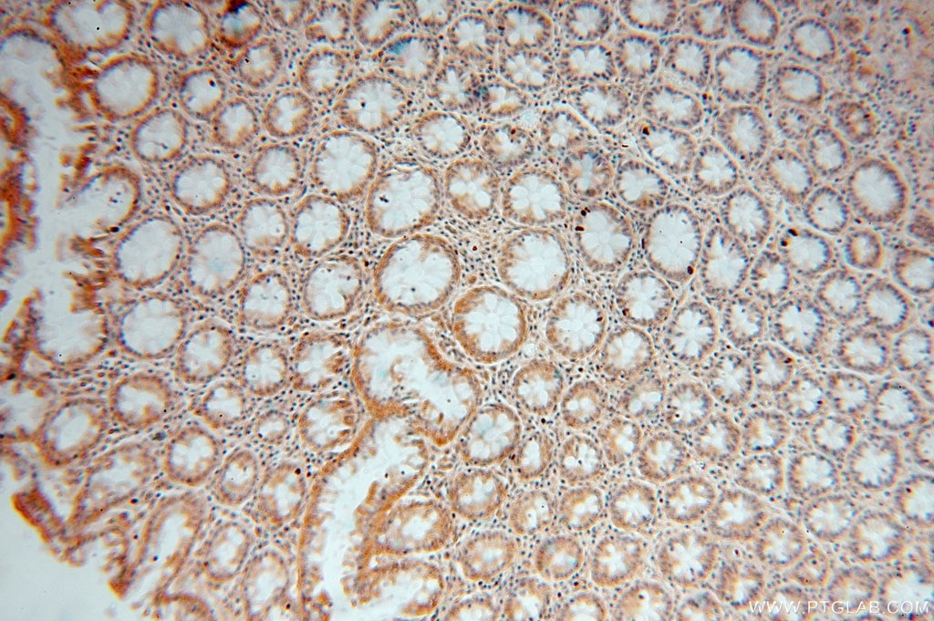 DDAH2 IHC Immunohistochemical 14966-1-AP DDAH2 Antibody DDAH; DDAHII; G6a; NG30