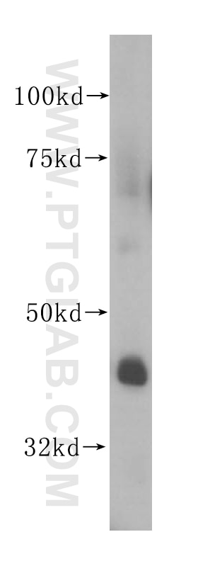DDAH2 western blot WB 14966-1-AP DDAH2 Antibody DDAH; DDAHII; G6a; NG30