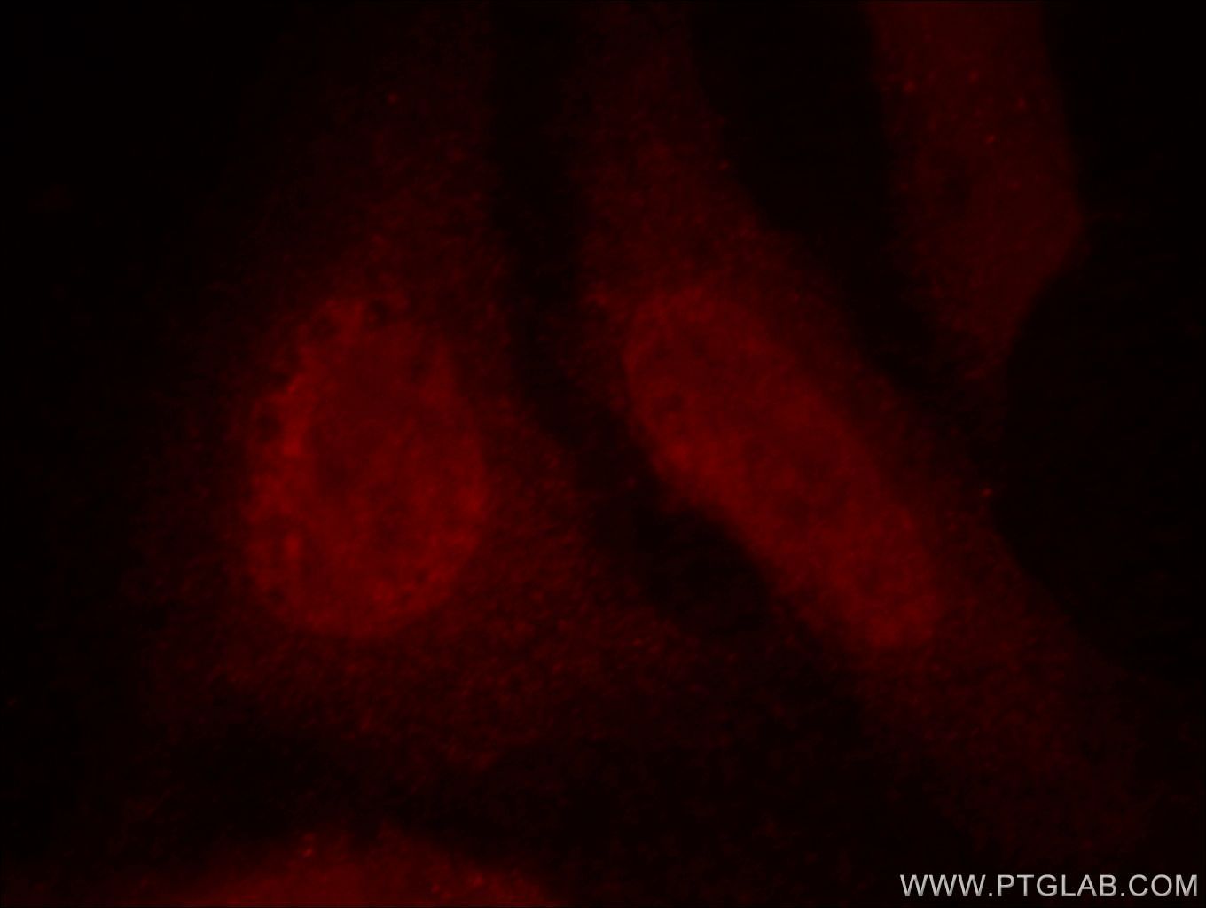 DDB1 Immunofluorescence IF 66010-1-Ig DDB1 Antibody DDBA; UV-DDB1; XAP1; XPCE; XPE; XPE-BF