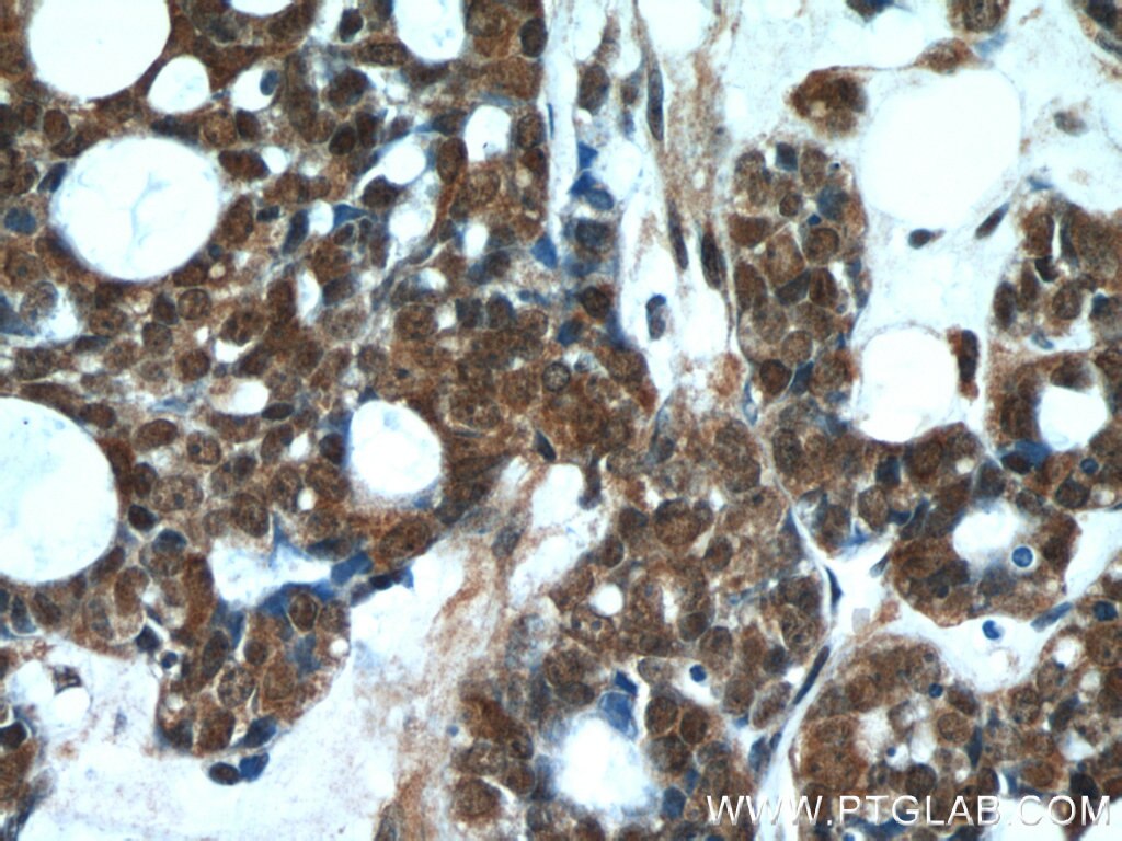 DDB1 IHC Immunohistochemical 66010-1-Ig DDB1 Antibody DDBA; UV-DDB1; XAP1; XPCE; XPE; XPE-BF