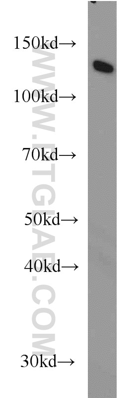 DDB1 western blot WB 66010-1-Ig DDB1 Antibody DDBA; UV-DDB1; XAP1; XPCE; XPE; XPE-BF