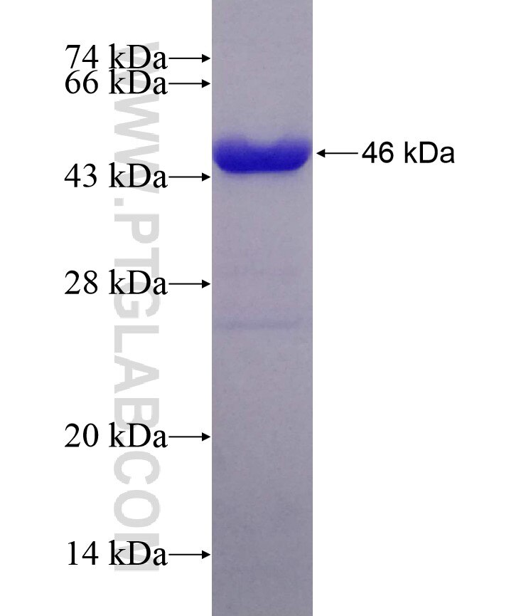 DDB1 fusion protein ag17903 SDS-PAGE