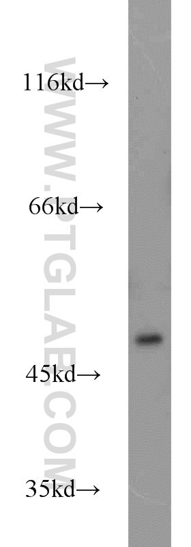 DDOST western blot WB 14916-1-AP DDOST Antibody AGE-R1; KIAA0115; MGC2191; OK/SW-cl.45; OST; OST48; WBP1