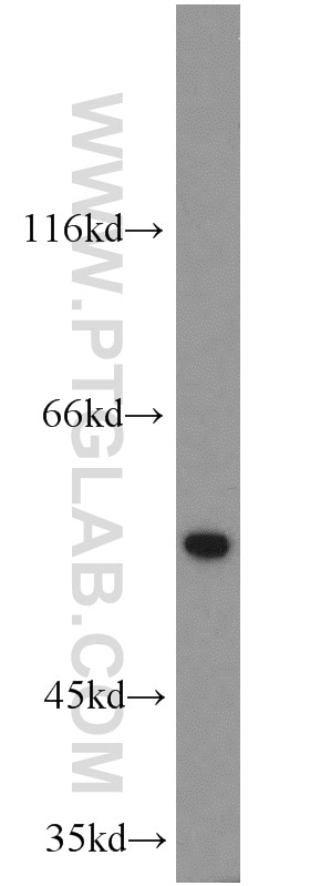 mouse testis tissue were subjected to SDS PAGE followed by western blot with 14370-1-AP(DDX25 Antibody) at dilution of 1:500 DDX25 western blot WB 14370-1-AP DDX25 Antibody GRTH