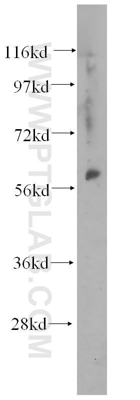A549 cells were subjected to SDS PAGE followed by western blot with 11617-1-AP(DDX28 Antibody) at dilution of 1:500 DDX28 western blot WB 11617-1-AP DDX28 Antibody FLJ11282; MDDX28