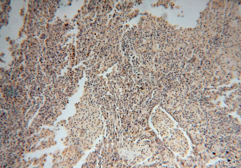 DDX43 IHC Immunohistochemical 17591-1-AP DDX43 Antibody CT13; DKFZp434H2114; HAGE