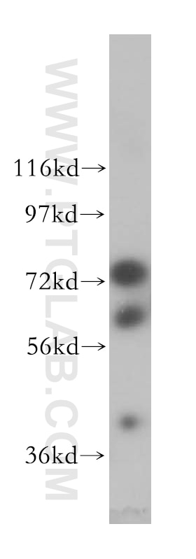 DDX43 western blot WB 17591-1-AP DDX43 Antibody CT13; DKFZp434H2114; HAGE
