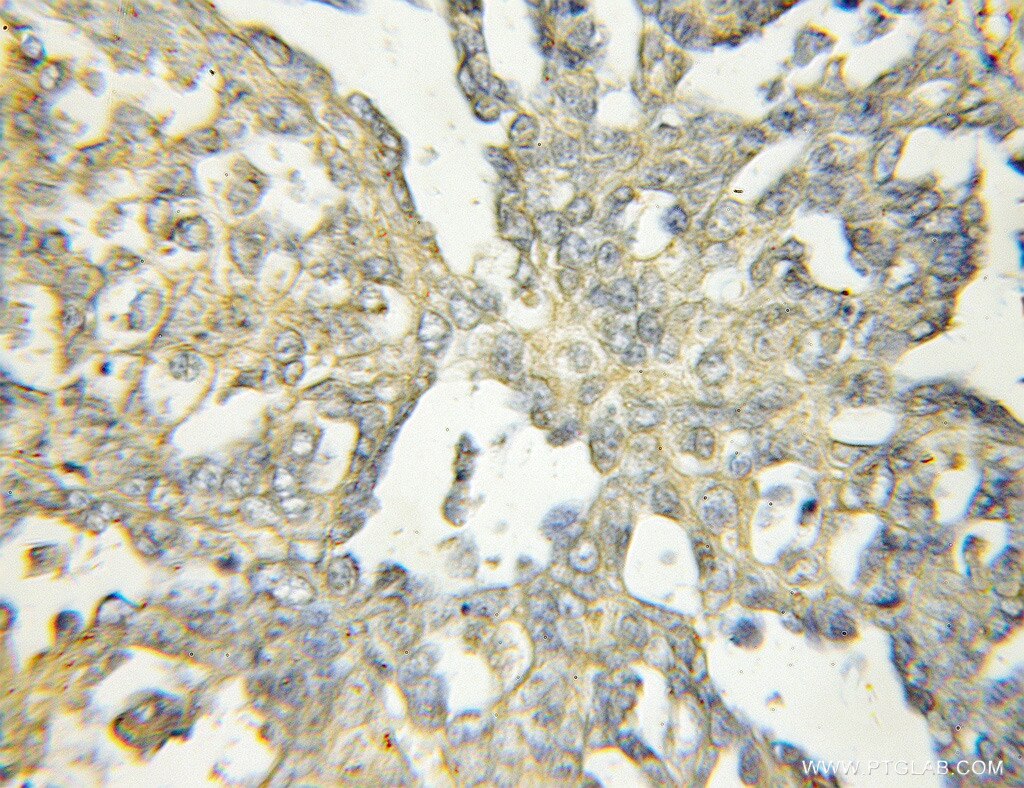 DEF6 IHC Immunohistochemical 11369-1-AP DEF6 Antibody IBP; SLAT