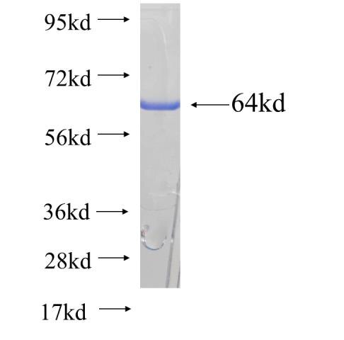 DES fusion protein ag9742 SDS-PAGE