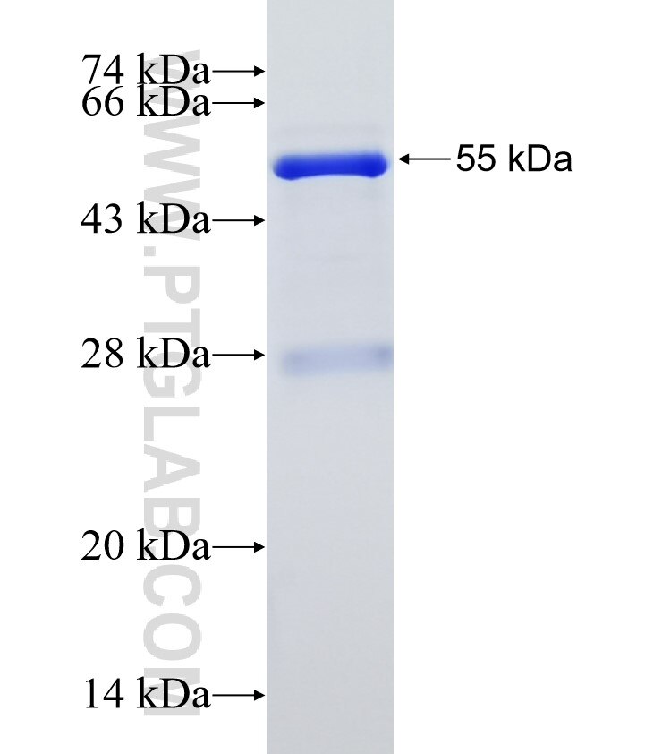 DGAT1 fusion protein ag2123 SDS-PAGE