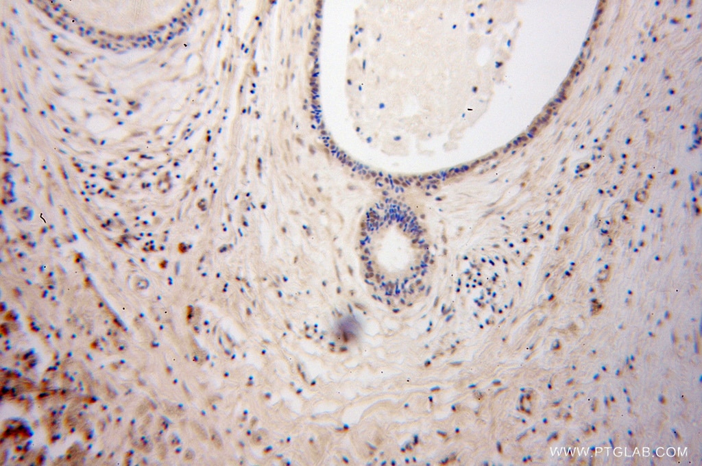 DGCR8 IHC Immunohistochemical 10996-1-AP DGCR8 Antibody C22orf12; DGCRK6; Gy1