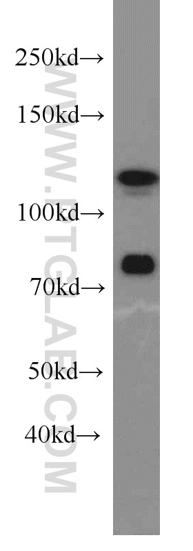 DGCR8 western blot WB 10996-1-AP DGCR8 Antibody C22orf12; DGCRK6; Gy1