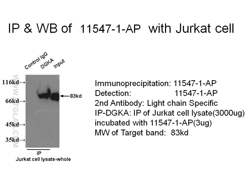 DGKA IP 11547-1-AP DGKA Antibody DAGK; DAGK1; DGK-alpha; MGC12821; MGC42356