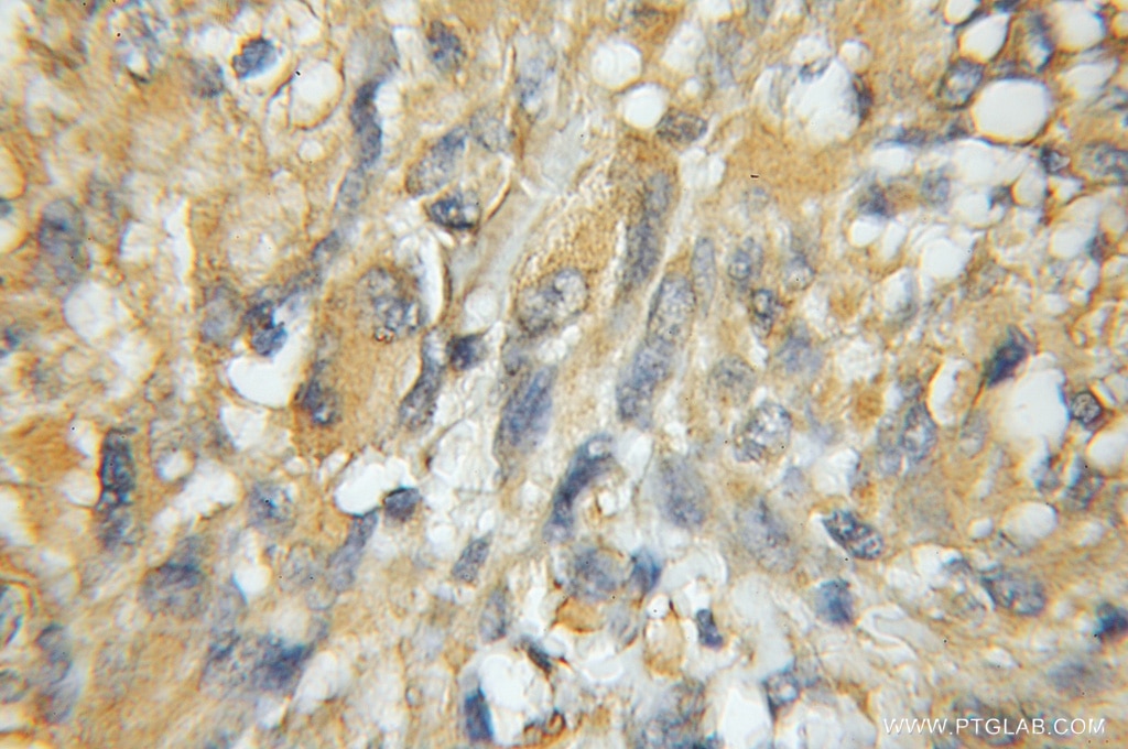 DGKA IHC Immunohistochemical 11547-1-AP DGKA Antibody DAGK; DAGK1; DGK-alpha; MGC12821; MGC42356