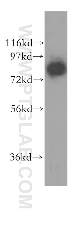 DGKA western blot WB 11547-1-AP DGKA Antibody DAGK; DAGK1; DGK-alpha; MGC12821; MGC42356