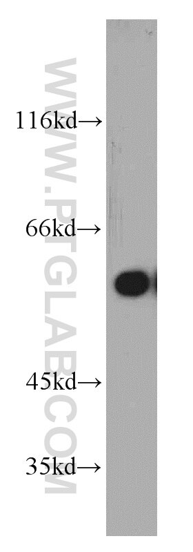 Jurkat cells were subjected to SDS PAGE followed by western blot with 10471-1-AP(DHCR24 Antibody) at dilution of 1:800 DHCR24 western blot WB 10471-1-AP DHCR24 Antibody KIAA0018; Nbla03646; SELADIN1; seladin-1