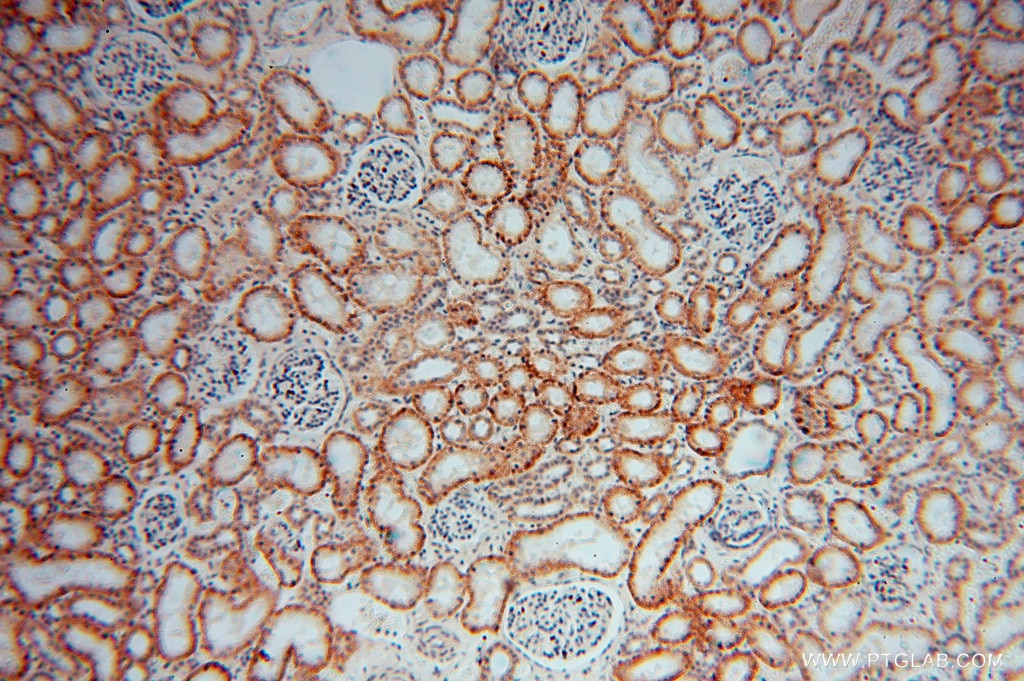 DHRS1 IHC Immunohistochemical 16275-1-AP DHRS1 Antibody DKFZp586I0523; FLJ14250; FLJ25430; MGC20204; SDR19C1