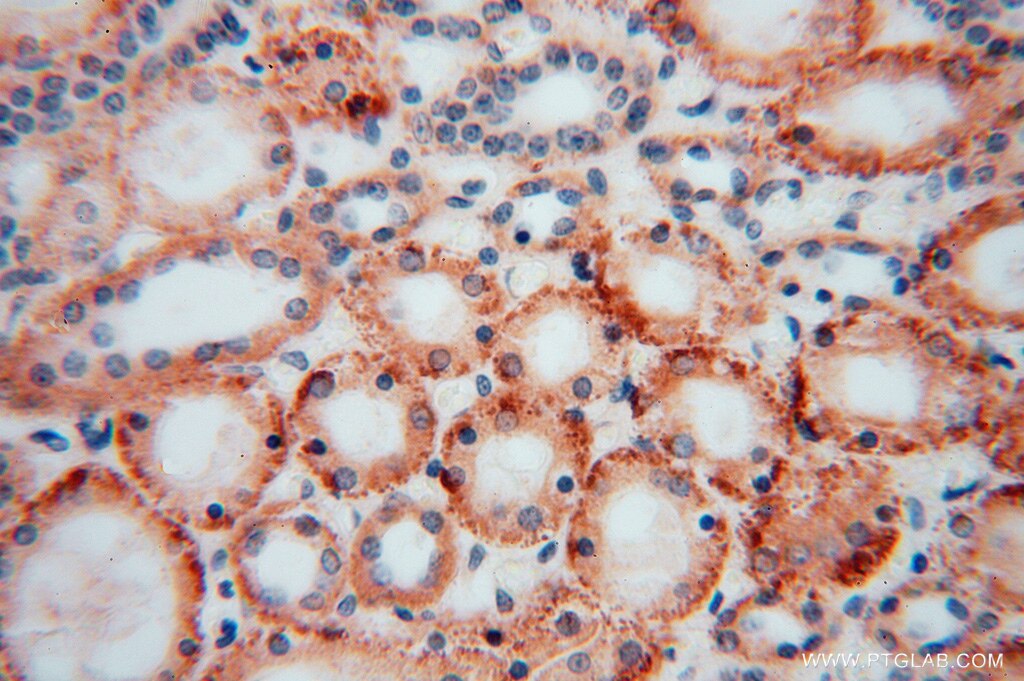 DHRS1 IHC Immunohistochemical 16275-1-AP DHRS1 Antibody DKFZp586I0523; FLJ14250; FLJ25430; MGC20204; SDR19C1