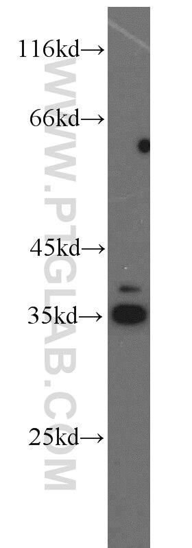 DHRS1 western blot WB 16275-1-AP DHRS1 Antibody DKFZp586I0523; FLJ14250; FLJ25430; MGC20204; SDR19C1