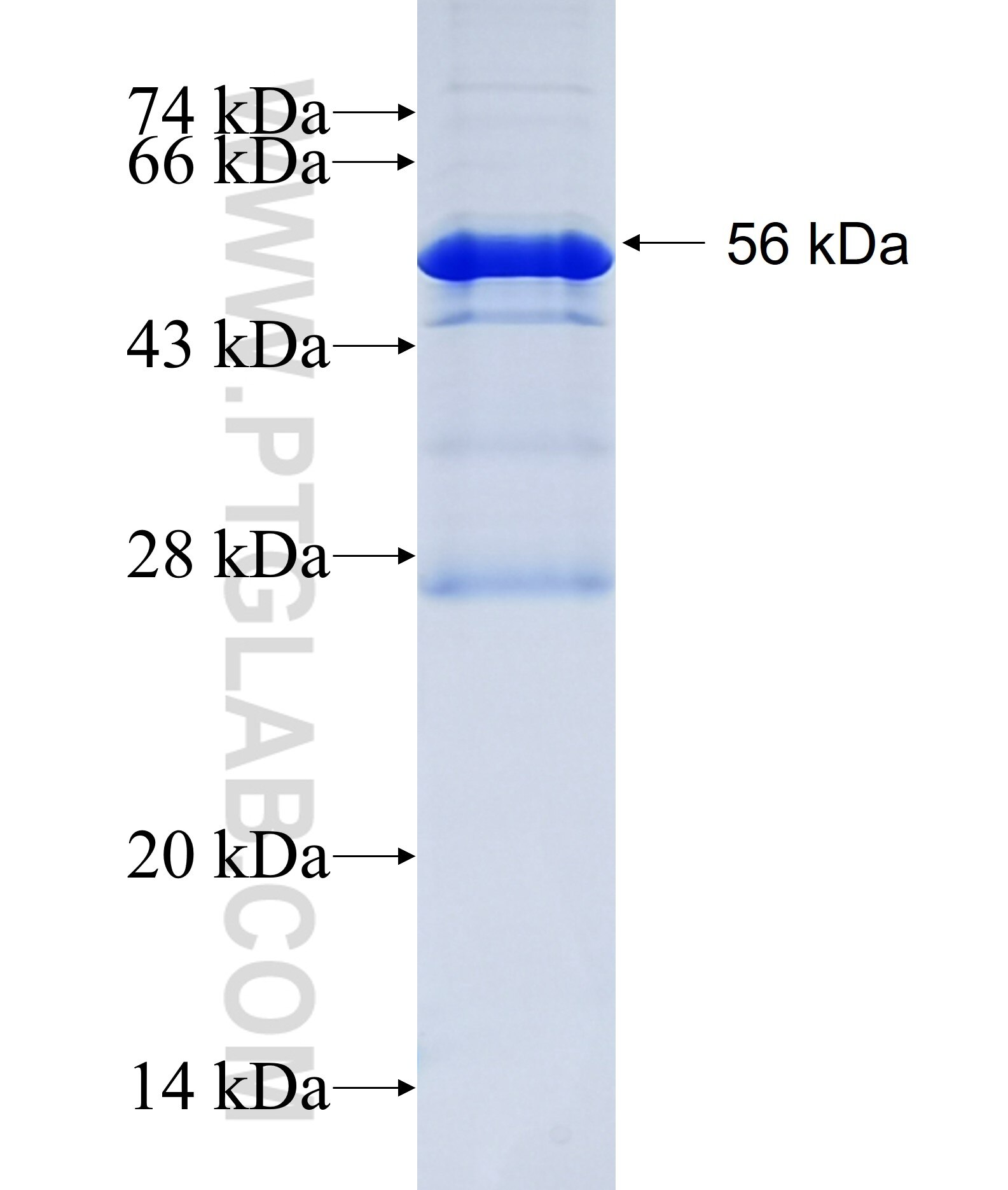 DHRS3 fusion protein ag7589 SDS-PAGE