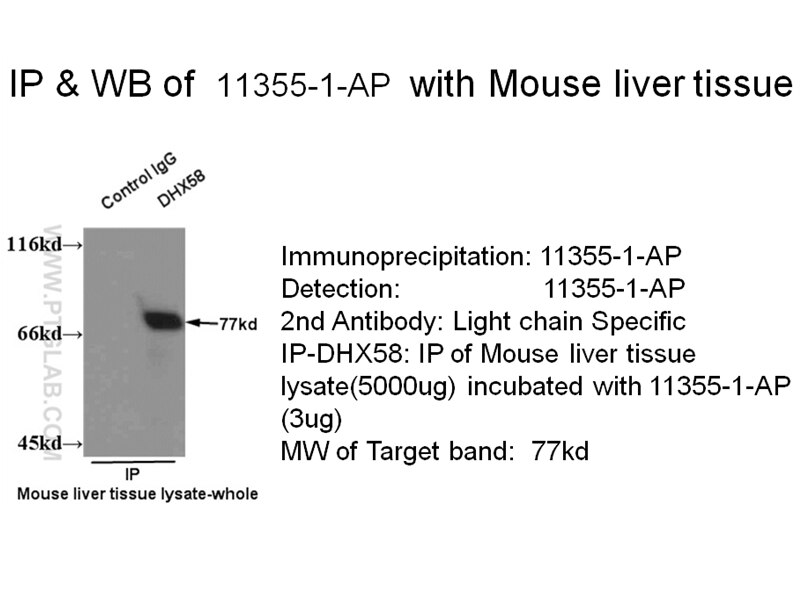 DHX58 IP 11355-1-AP DHX58 Antibody D11LGP2; D11lgp2e; LGP2