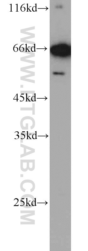 DHX58 western blot WB 11355-1-AP DHX58 Antibody D11LGP2; D11lgp2e; LGP2