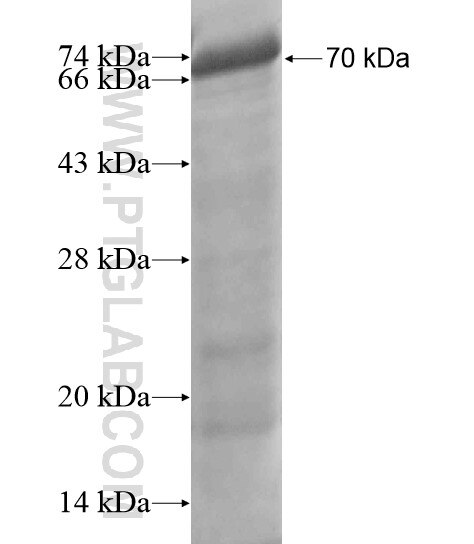 DKFZP564O0823 fusion protein ag19984 SDS-PAGE