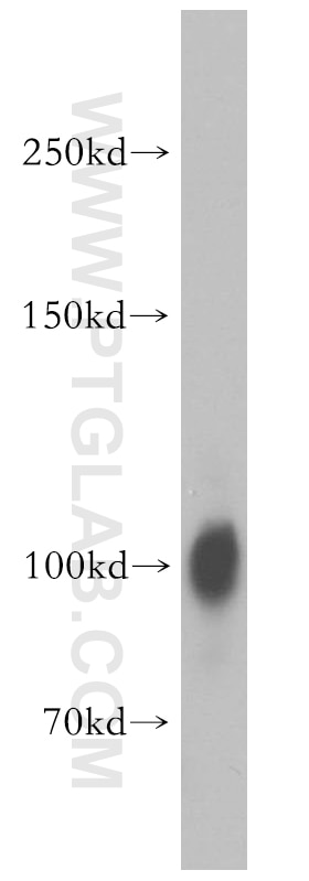 mouse brain tissue were subjected to SDS PAGE followed by western blot with 18036-1-AP(DLG3 Antibody) at dilution of 1:2000 DLG3 western blot WB 18036-1-AP DLG3 Antibody KIAA1232; MRX; MRX90; NE-Dlg; NEDLG; SAP-102; SAP102