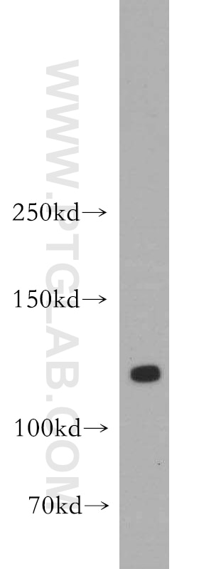 human brain tissue were subjected to SDS PAGE followed by western blot with 55056-1-AP(DLGAP3 Antibody) at dilution of 1:500 DLGAP3 western blot WB 55056-1-AP DLGAP3 Antibody DAP3; SAPAP3