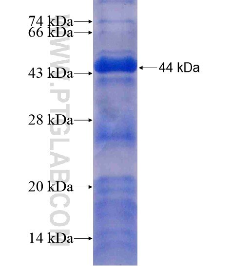 DMXL2 fusion protein ag19861 SDS-PAGE