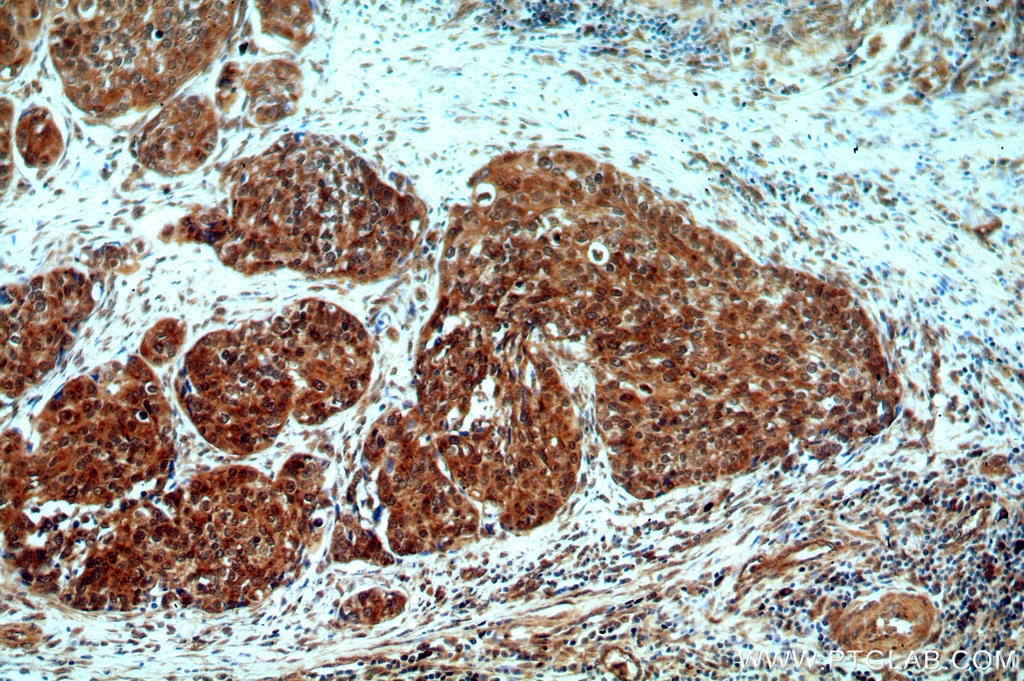 DNA2 IHC Immunohistochemical 18727-1-AP DNA2 Antibody DNA2L; FLJ10063; KIAA0083; MGC133297