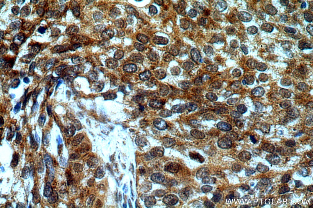DNA2 IHC Immunohistochemical 18727-1-AP DNA2 Antibody DNA2L; FLJ10063; KIAA0083; MGC133297