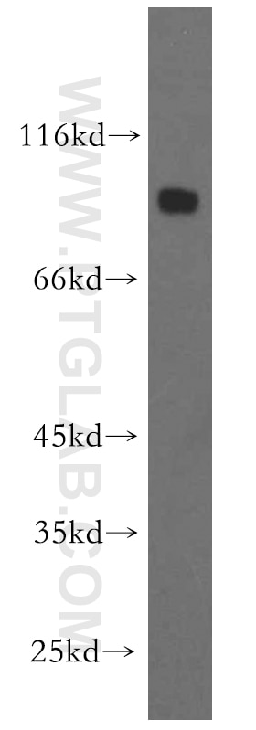 human brain tissue were subjected to SDS PAGE followed by western blot with 12756-1-AP(DNAI1 Antibody) at dilution of 1:1000 DNAI1 western blot WB 12756-1-AP DNAI1 Antibody CILD1; ICS; ICS1; MGC26204; PCD
