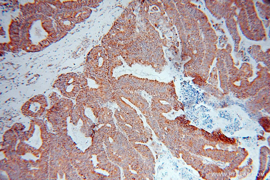 DNAJB11 IHC Immunohistochemical 15484-1-AP DNAJB11 Antibody ABBP-2; ABBP2; DJ9; EDJ; ERdj3; ERj3; HEDJ; PRO1080; UNQ537; hDj9