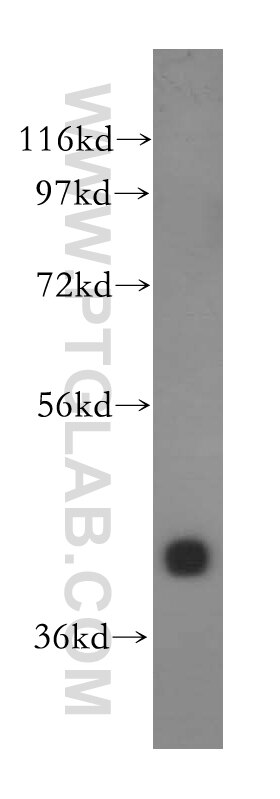 DNAJB11 western blot WB 15484-1-AP DNAJB11 Antibody ABBP-2; ABBP2; DJ9; EDJ; ERdj3; ERj3; HEDJ; PRO1080; UNQ537; hDj9